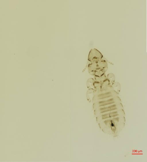 Brueelia brevipennis Ansari, 1956 - 010670537__2017_07_28-Scene-1-ScanRegion0