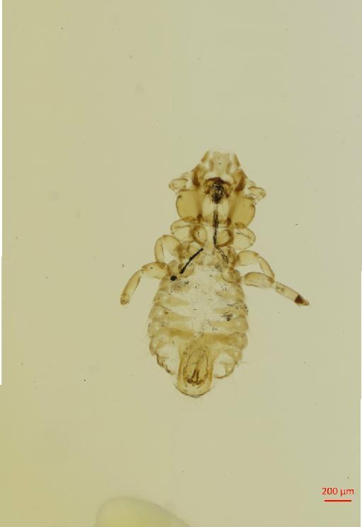 Strigiphilus laticephalus Uchida, 1949 - 010693553__2017_08_11-Scene-1-ScanRegion0