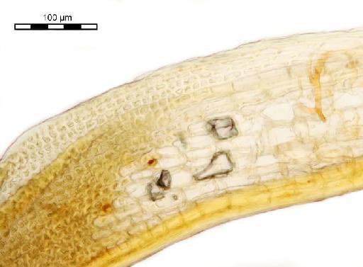 Syrrhopodon semperi Müll.Hal. - Syrrhopodon richardsii_BM000675259shoulder.jp