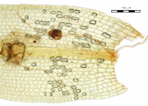 Leptodontium styriacum (Jur.) Limpr. - Didymodon styriacus_BM001006430leafbase.j