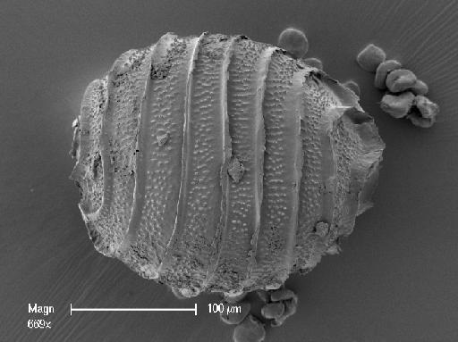 Nitella remota A.Braun - OosporeSide