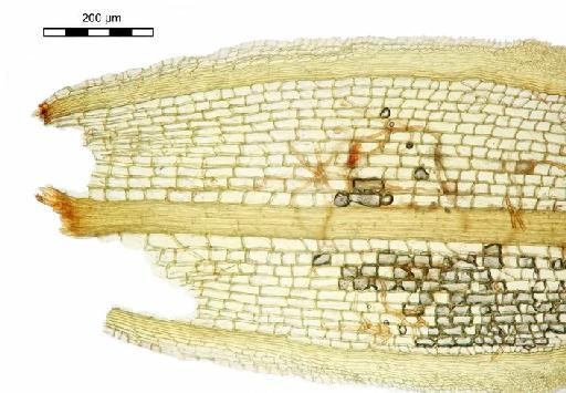 Calymperes afzelii Sw. - Calymperes dusenii_BM000855256base.jpg