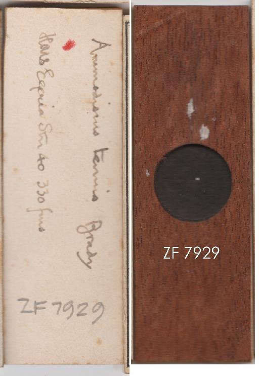 Ammodiscus tenuis Brady 1881 - ZF 7929.tif