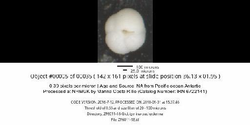 Neogloboquadrina pachyderma (Ehrenberg) - ZF6011-18-Globigerina-pachyderma_obj00005_plane000.jpg