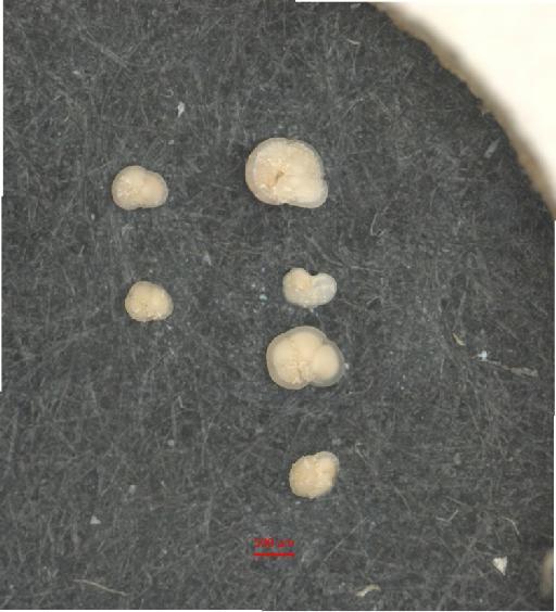 Globorotalia menardii (d'Orbigny) - ZF5789