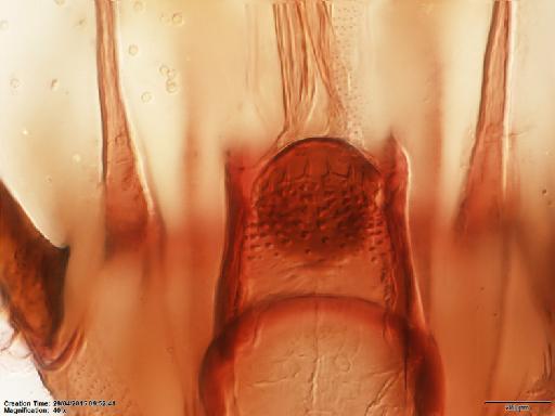 Lutzomyia (Psathyromyia) dasymera Fairchild & Hertig, 1961 - Lutzomyia_dasymera-BMNH(E)1251324_PT-female_cibarium-40x.tif