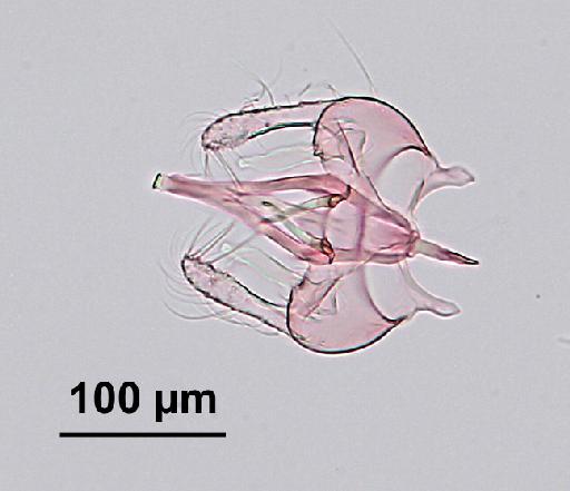 Trichomyia crucis Duckhouse, 1978 - Trichomyia_crucis-010210255-genitalia-160_0x-scale