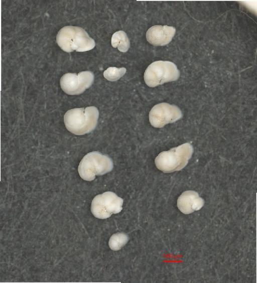 Globorotalia tumida (Brady) - ZF5810