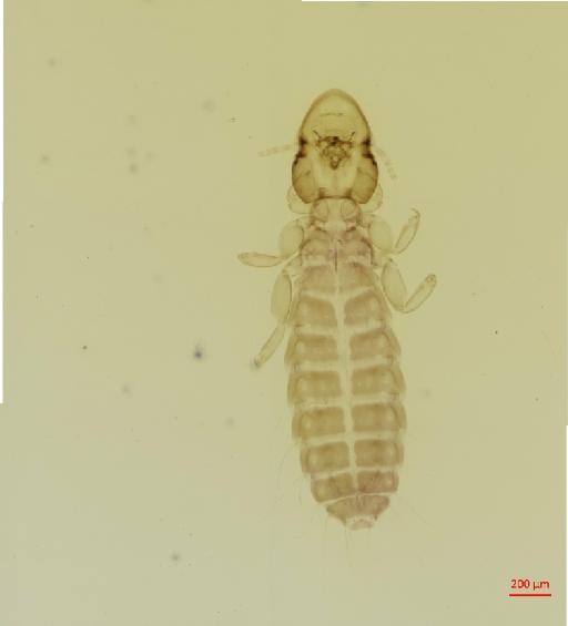 Syrrhaptoecus digonus Waterston, 1928 - 010694719__2017_08_15-Scene-1-ScanRegion0