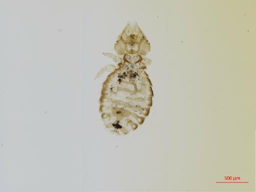 Sturnidoecus acutifrons Ansari, 1968 - 010694486__2017_08_11-Scene-1-ScanRegion0