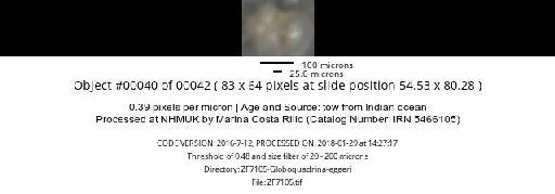 Neogloboquadrina dutertrei (d'Orbigny) - ZF7105-Globoquadrina-eggeri_obj00040_plane000.jpg