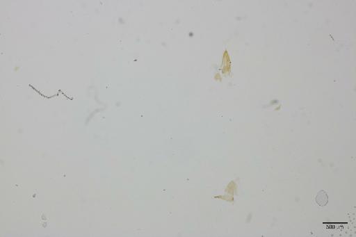Isogonoceraia divergipennis White & Hodkinson, 1980 - 013482908_d
