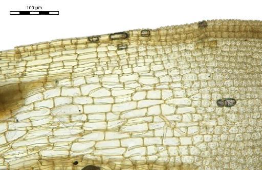 Syntrichia sinensis (Müll.Hal.) Ochyra - Barbula alpina_BM000575992hyaline2.jpg