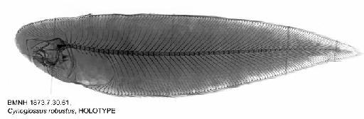 Cynoglossus robustus Günther, 1873 - BMNH 1873.7.30.61, Cynoglossus robustus, HOLOTYPE, Radiograph