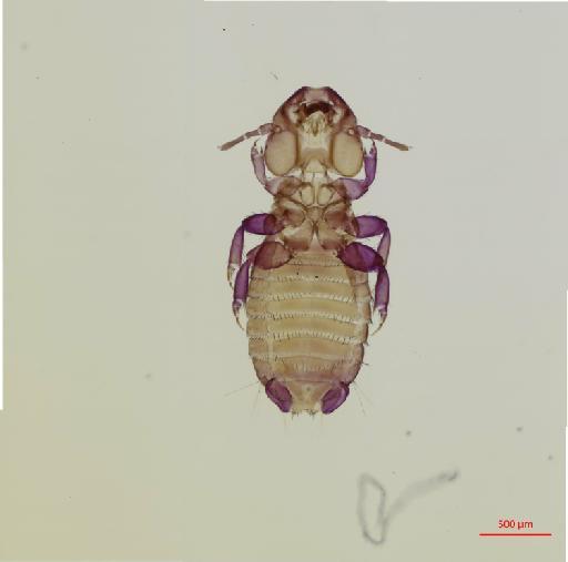 Eutrichophilus cordiceps Mjoberg, 1910 - 010696565__2017_08_16-Scene-1-ScanRegion0