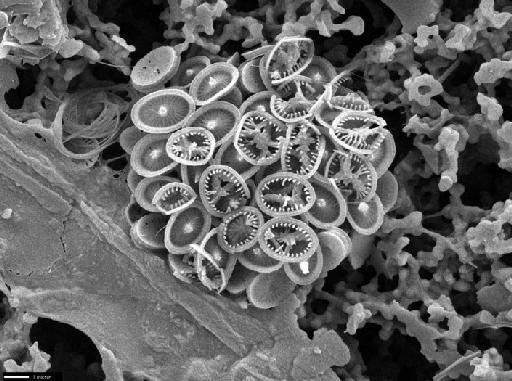 Syracosphaera histrica - CSF0085.TIF
