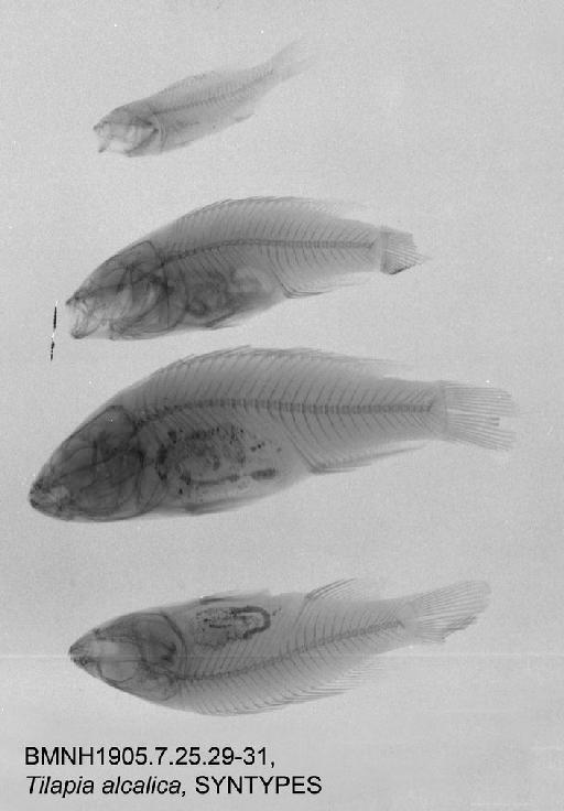 Tilapia alcalica Hilgendorf, 1905 - BMNH 1905.7.25.29-31, SYNTYPES, Tilapia alcalica Radiograph