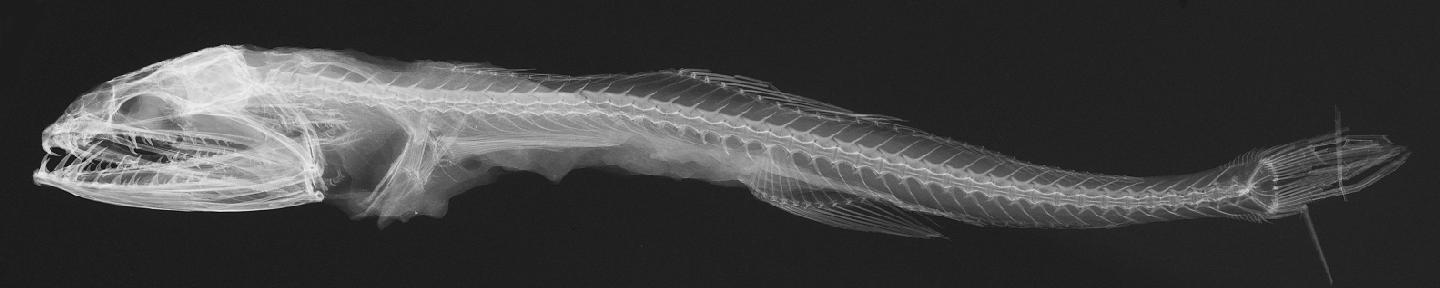 To NHMUK collection (Chiasmodon niger Johnson, 1864; HOLOTYPE; NHMUK:ecatalogue:2595137)