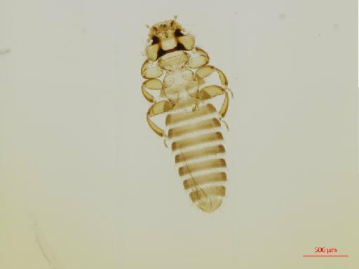 Colpocephalum spinicollis Price & Beer, 1965 - 010654015__2017_07_19-Scene-1-ScanRegion0