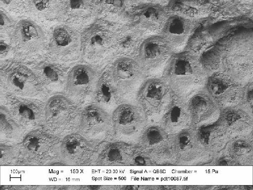 Onychocella Jullien, 1882 - SEM photograph pdt 10087