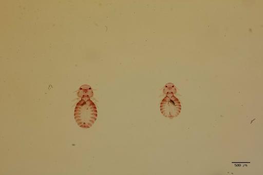 Goniocotes nigromaculatus Mjoberg, 1910 - 010675757_specimen