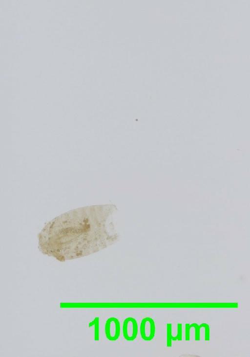 Liposcelis albothoracicus Broadhead, 1955 - 010150233__2016_03_15-4_s12