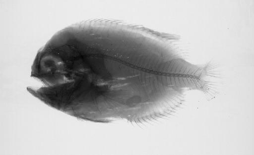 Platyberyx opalescens Zugmayer, 1911 - BMNH 1998.8.9.18619, Platyberyx opalescens, radiograph2