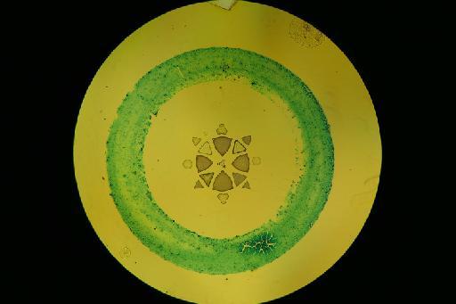 Bacillariophyceae Haeckel - Diatom BM 0088040