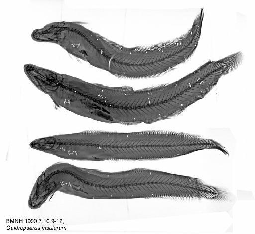 Gaidropsarus insularum Sivertsen, 1945 - BMNH 1990.7.10.9-12, Gaidropsarus insularum, Radiograph