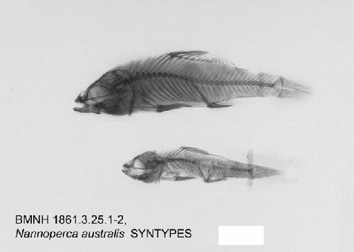 Nannoperca australis Günther, 1861 - BMNH 1861.3.25.1-2, SYNTYPES, Nannoperca australis, radiograph