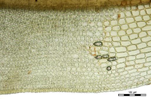 Tortula madagassa Dixon - Tortula madagassa_BM000870447hyaline.jpg
