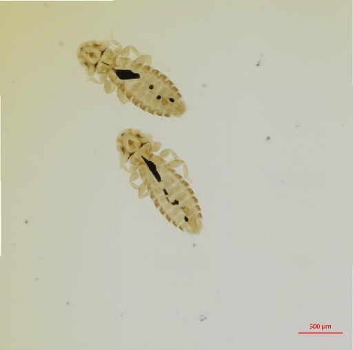 Pseudomenopon qadrii Eichler, 1952 - 010663565__2017_07_26-Scene-1-ScanRegion0