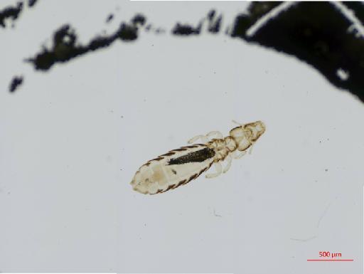 Quadraceps novaeseelandiae Timmermann, 1953 - 010687758__2017_08_10-Scene-1-ScanRegion0