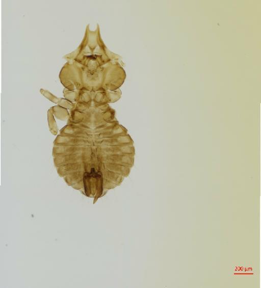 Saemundssonia (Puffinoecus) jamaicensis Timmermann, 1962 - 010691290__2017_08_11-Scene-1-ScanRegion0