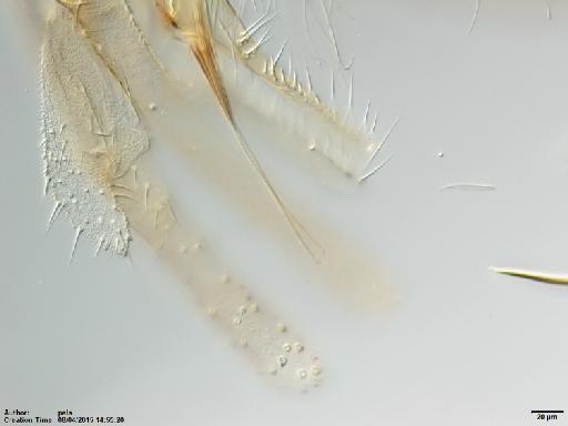 Lutzomyia (Helcocyrtomyia) strictivilla Young, 1979 - Lutzomyia_strictivilla-BMNH(E)1722009_PT-male_sperm_duct_apex-20x.tif