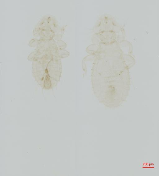 Myrsidea duplicata Tandan, 1972 - 010661841__2017_07_24-Scene-1-ScanRegion0