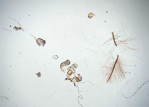 Paratendipes seydeli Freeman, 1957 - 010210312-Paratendipes_seydeli_HOLOTYPE-head_B-50_0x