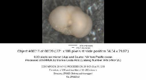 Neogloboquadrina dutertrei (d'Orbigny) - ZF6420-Globoquadrina-eggeri_obj00018_plane000.jpg