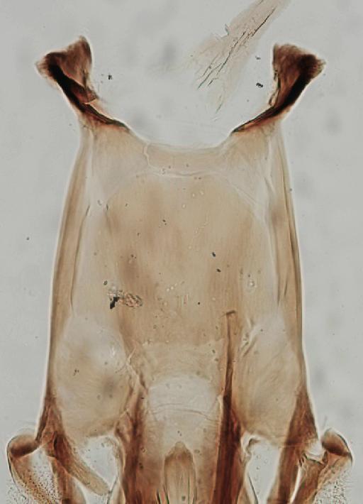 Simulium (Trichodagmia) tarsale species group Tarsatum Williston, 1896 - 010195844_S_tarsale_Paralectotype_female_cibarium