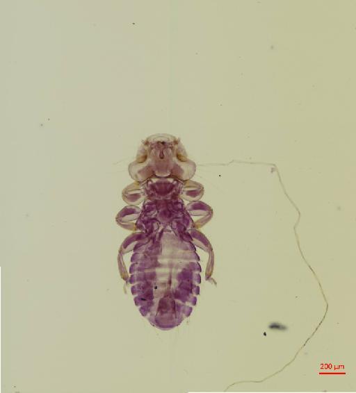 Myrsidea elegans Ansari, 1956 - 010661873__2017_07_24-Scene-1-ScanRegion0