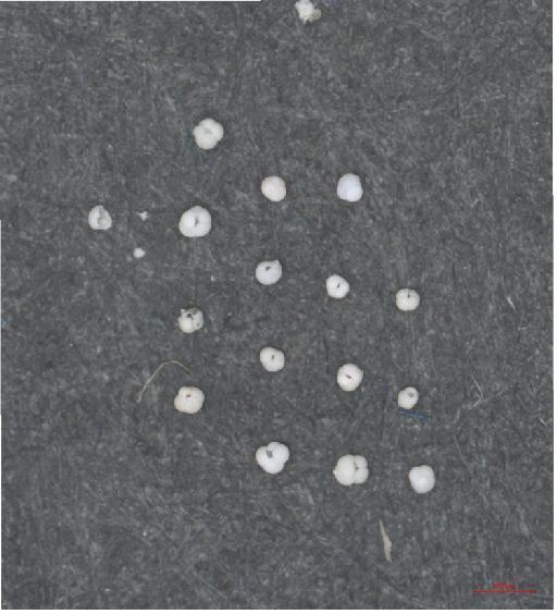 Globigerina pachyderma Ehrenberg - ZF6027 (2)
