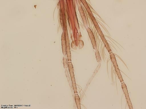Lutzomyia (Psathyromyia) dasymera Fairchild & Hertig, 1961 - Lutzomyia_dasymera-BMNH(E)1251322_PT-male_mouthparts-10x.tif