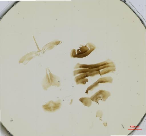 Hexacladia impiros Noyes, 2010 - 010178954__2017_01_31-Scene-3-ScanRegion2