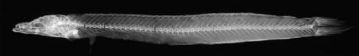 Bleekeria kallolepis Günther, 1862 - BMNH 1846.11.22. - Bleekeria kallolepis HOLOTYPE Radiograph