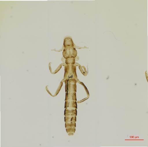 Anaticola cairinensis Monyeiro de Barros, 1933 - 010665954__2017_07_27-Scene-1-ScanRegion0