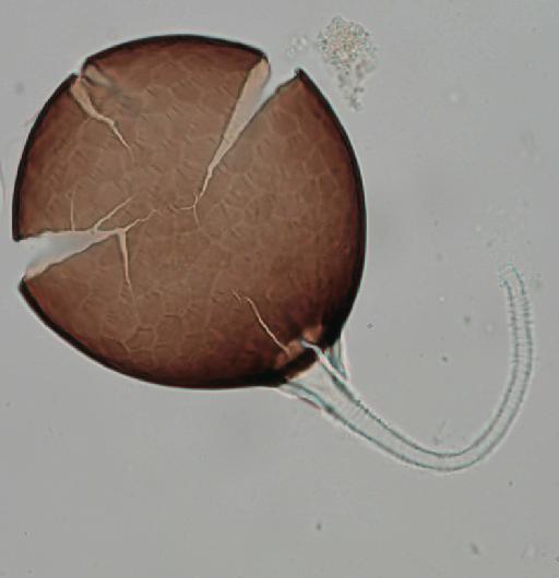 Simulium (Trichodagmia) tarsale species group Tarsatum Williston, 1896 - 010195843_S_tarsale_Lectotype_female_spermatheca