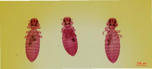 Colpocephalum pennivorum Eichler - 010655816__2017_07_20-Scene-1-ScanRegion0