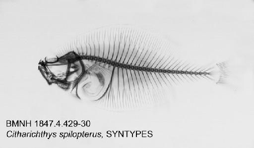 Citharichthys spilopterus Günther, 1862 - BMNH 1847.4.4.29-30, SYNTYPES, Citharichthys spilopterus