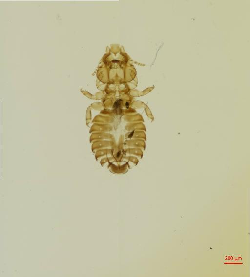 Anatoecus brunneopygus Mjoberg, 1910 - 010666818__2017_07_28-Scene-3-ScanRegion2