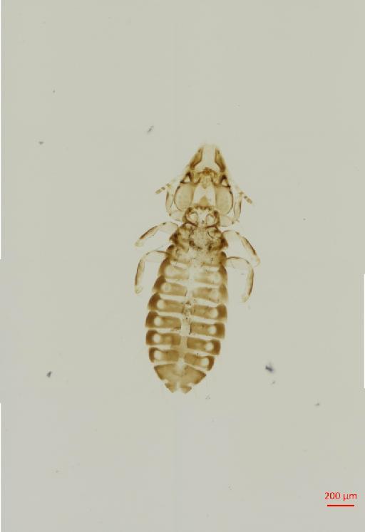 Rallicola unguiculatus Piaget, 1880 - 010690255__2017_08_11-Scene-1-ScanRegion0